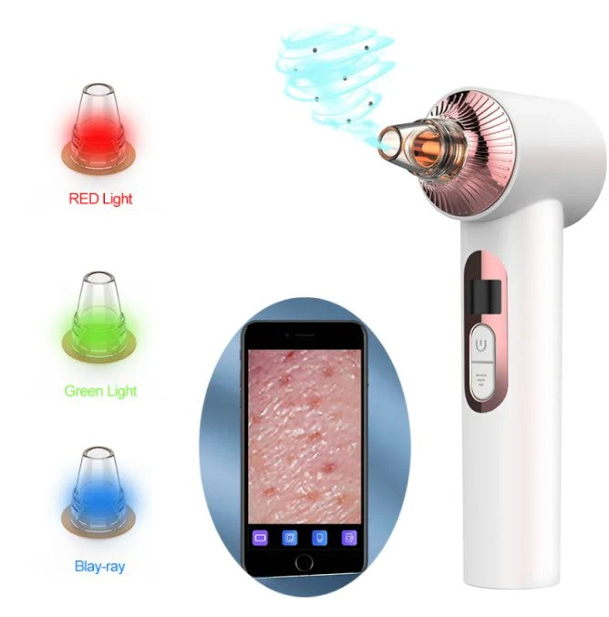 Veloza Blackhead Remover PRO
